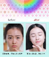 光端粒酶激活仪